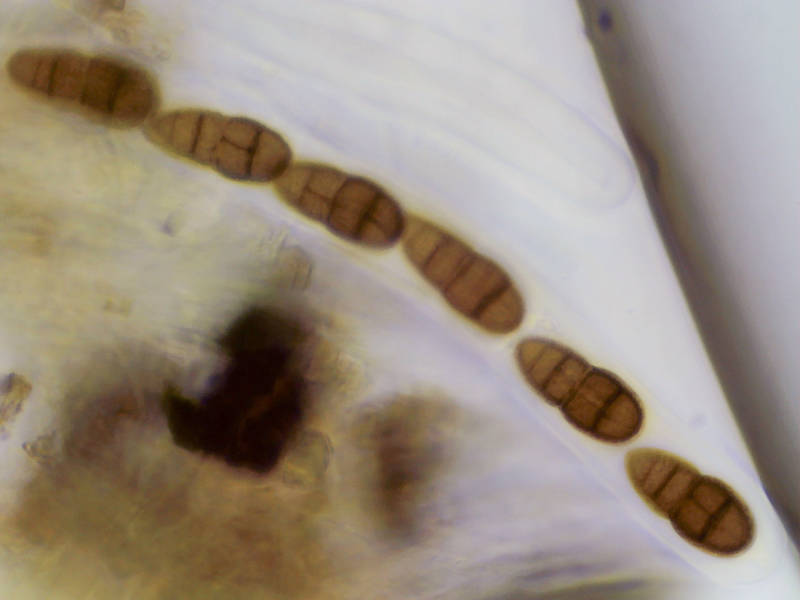 Asci with spores of black Hysteroid pyrenomycetous fungus <B>Hysterium angustatum</B>(?) under a microscope in KOH, collected in Washington-on-the-Brazos State Historic Site. Washington, Texas, May 22, 2022