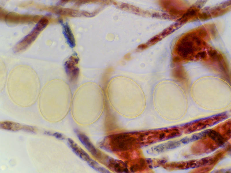 Asci and paraphyses under a microscope (in lugol, with x100 objective) of Ascomycete fungus <B>Scutellinia nigrohirtula</B>(?) or may be S. subhirtella with somewhat short hairs, or immature short-haired S. crinita collected in Lick Creek Park. College Station, Texas, March 7, 2023