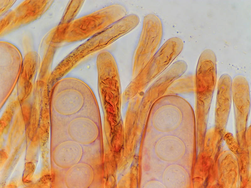 Paraphyses and asci under a microscope (with x100 objective) of Ascomycete fungus <B>Scutellinia nigrohirtula</B>(?) or may be S. subhirtella with somewhat short hairs, or immature short-haired S. crinita collected in Lick Creek Park. College Station, Texas, March 7, 2023